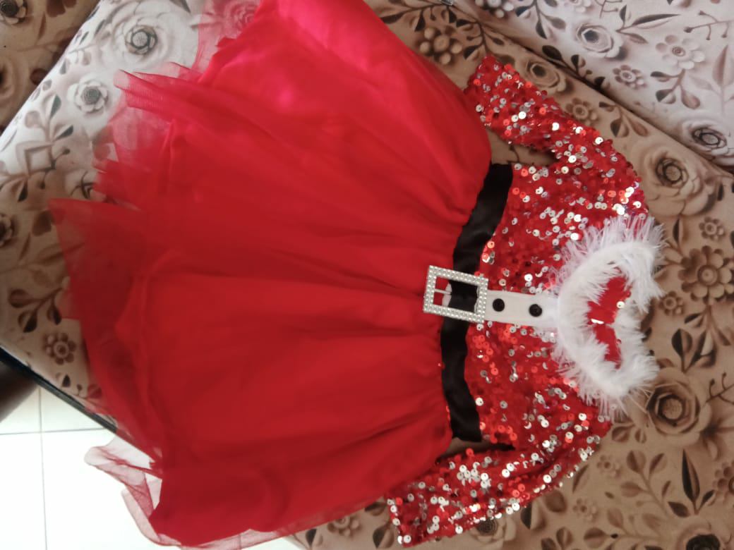 Baby’s Festive Christmas Frock – Adorable Holiday Outfit!